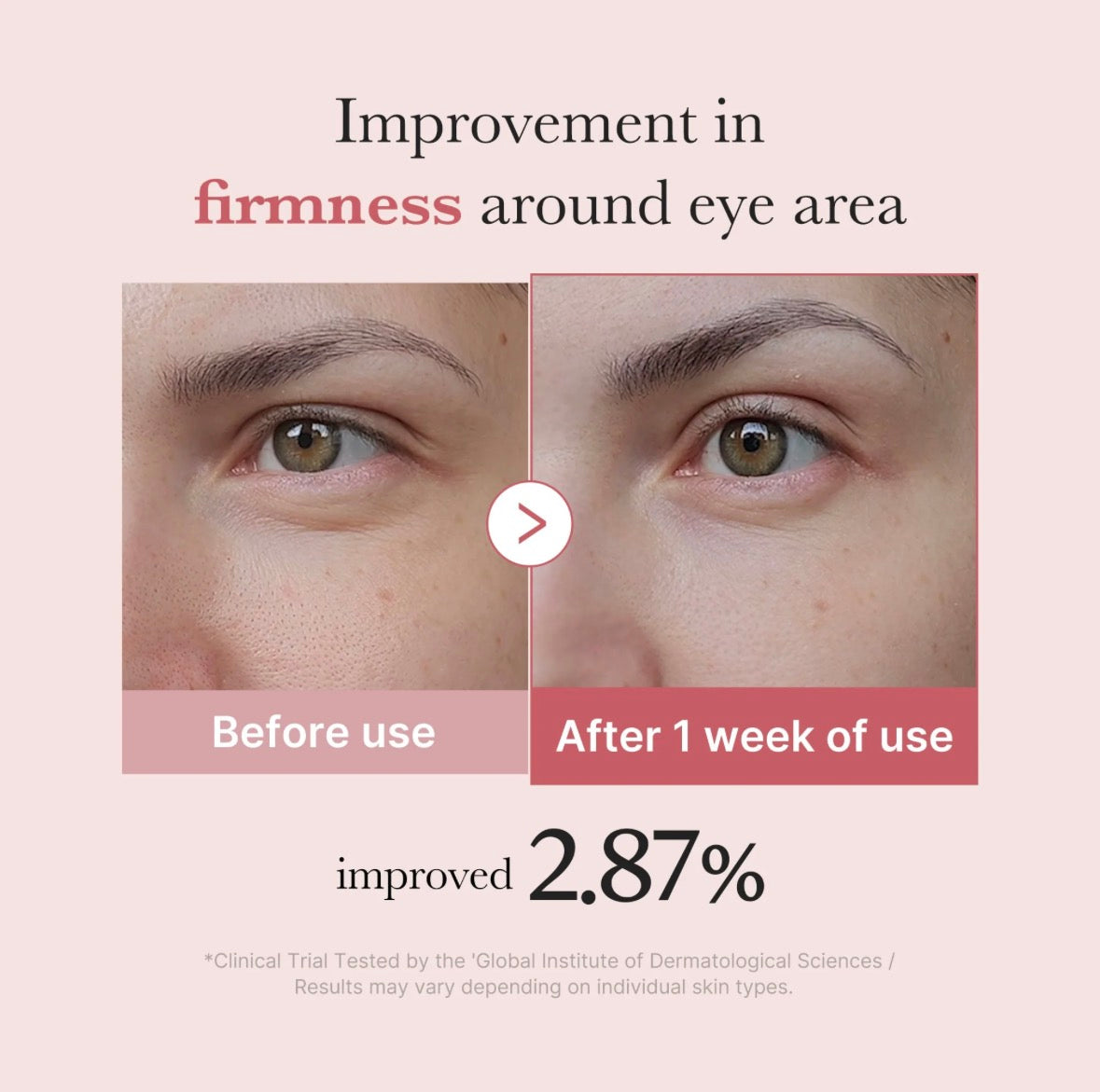 Sérum Contour des Yeux Pink Peptide PDRN Medicube