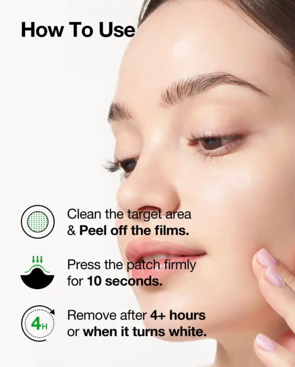 Anua Triple Acid Spot Care Microdart Patch : AHA, BHA & PHA - 12 pcs