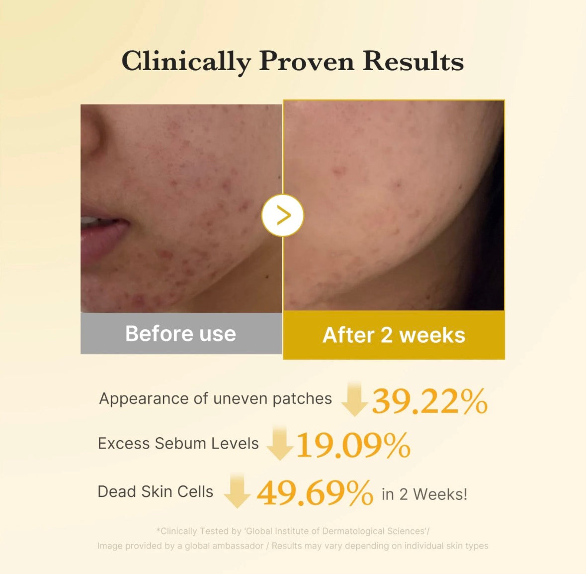 Disques Toniques Éclaircissants Kojic Acid Medicube – Visage & Corps