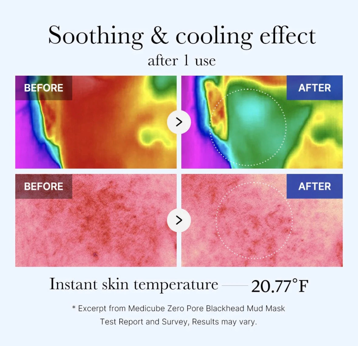 Masque à l'Argile Anti Points-Noirs Zero Pore Medicube