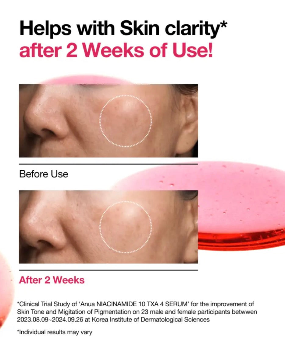 Anua Sérum Anti-Taches Niacinamide 10 % + TXA 4 % : Éclat & Correction – 30 ml