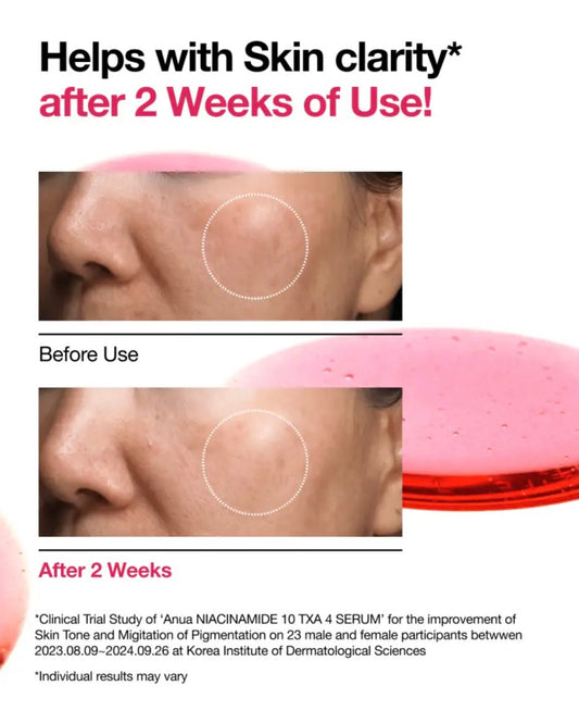 Anua Sérum Anti-Taches Niacinamide 10 % + TXA 4 % : Éclat & Correction – 30 ml