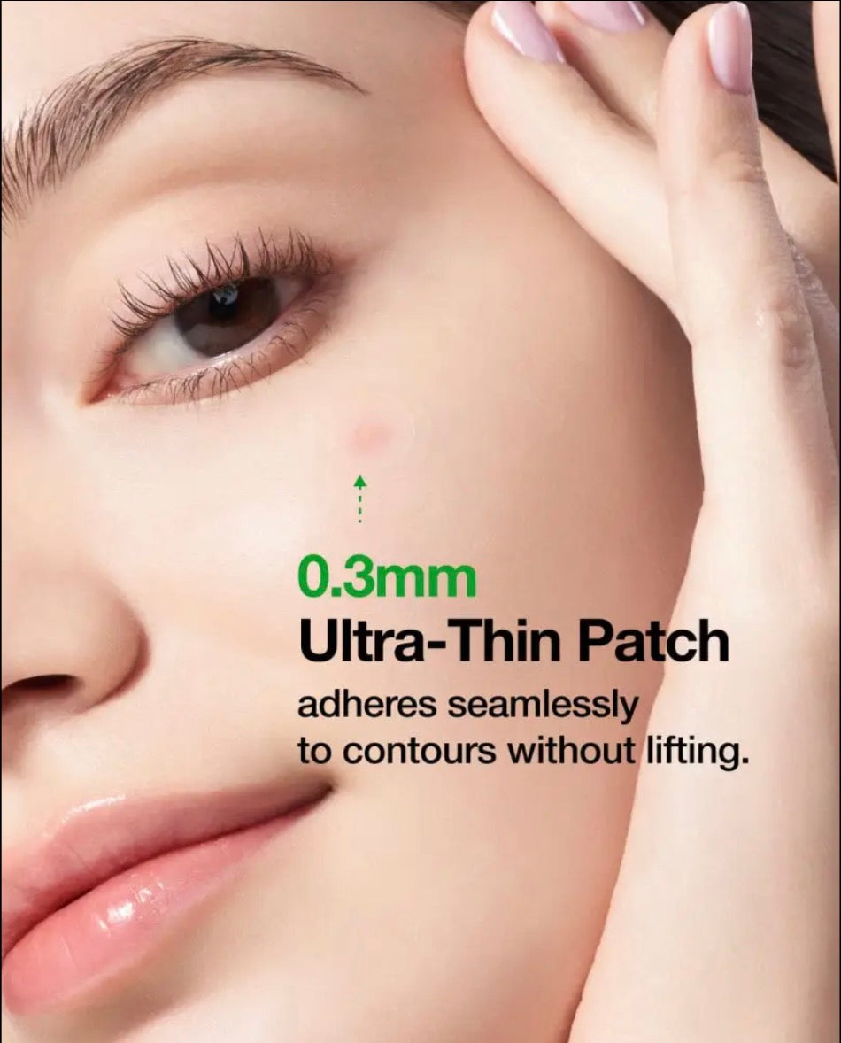 Anua Triple Acid Spot Care Microdart Patch : AHA, BHA & PHA - 12 pcs